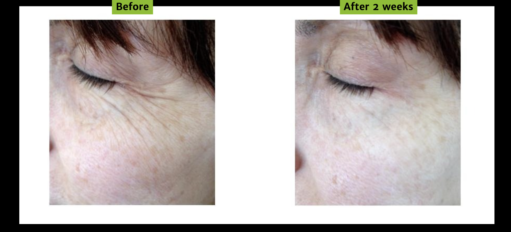 ナノソーマクリーム 30ml MagicDichol Health :: NANO SOMA® Skin Cream - MagicDichol LLC - NANO SOMA